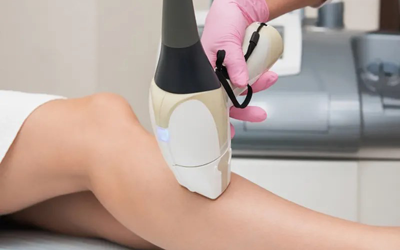 مراقبتهای پیشگیرانه پس از لیزر